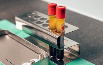 Two vials of blood on table