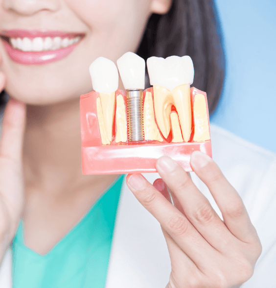 A woman demonstrates a dental implant using a tooth model in a dentistry setting.
