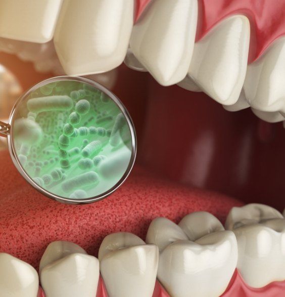 Animated smile with highlighted bacteria representing oral pathology